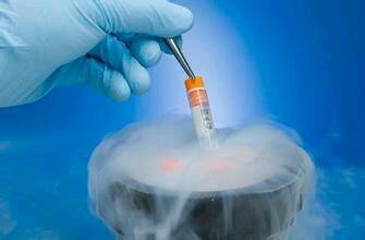 体外受精 IVF-ET